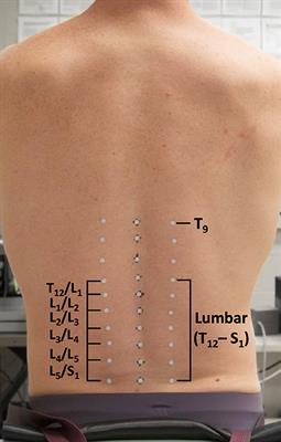 Characterizing Local Dynamic Stability of Lumbar Spine Sub-regions During Repetitive Trunk Flexion-Extension Movements